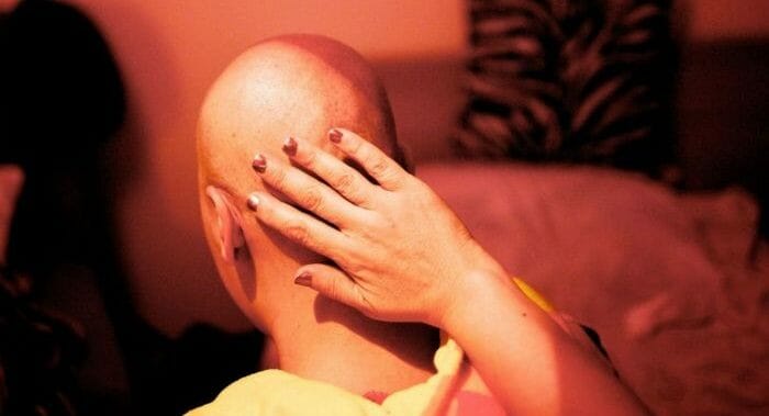 Chemo patient losing her hair