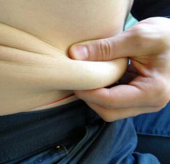 fat stomach pinch