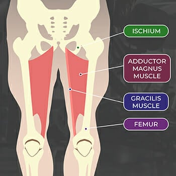 ischial tuberosity