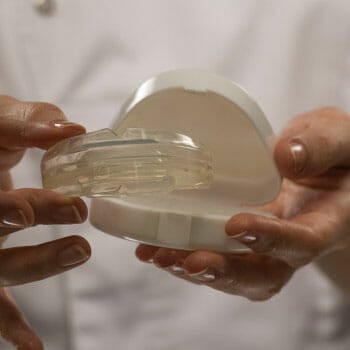 dentist holding a Orthodontic Mouthguard