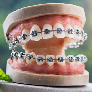 teeth model with braces