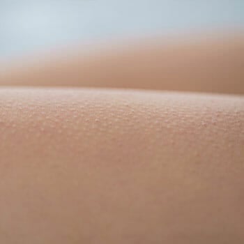 human skin having a goosebumps