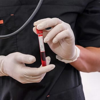 medical nurse in surgical gloves holding a vial with blood inside