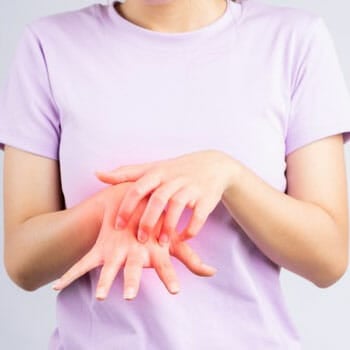 woman scratching her hands