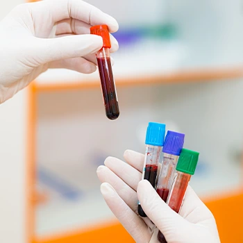 vials of blood samples