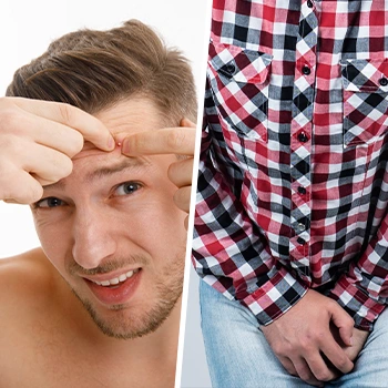 man with acne and another man covering his crouch