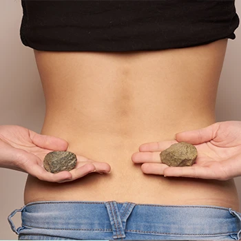 Woman holding two stones to symbolize kidney