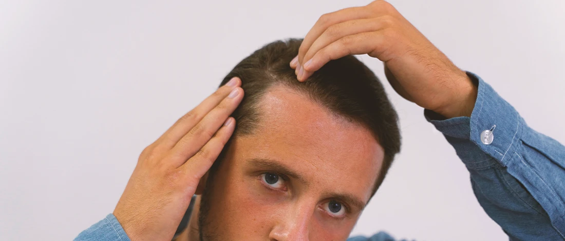 can-steroids-cause-hair-loss-according-to-a-doctor