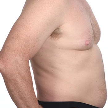 A male body fat upper body