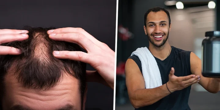 Holding pre-workout supplement, a man with hair loss