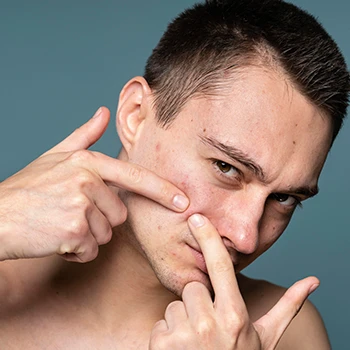 Portrait of man popping at acne