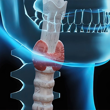 A 3D model of Hypothyroidism