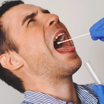 A doctor taking saliva samples for testosterone test
