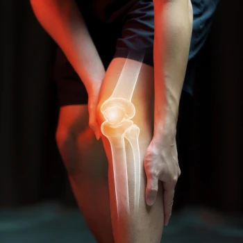 Joint pain image
