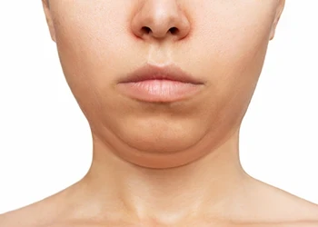 A woman with double chin