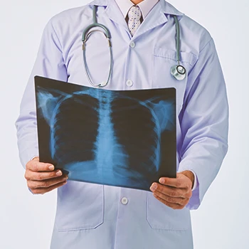 A doctor looking at a chest x-ray