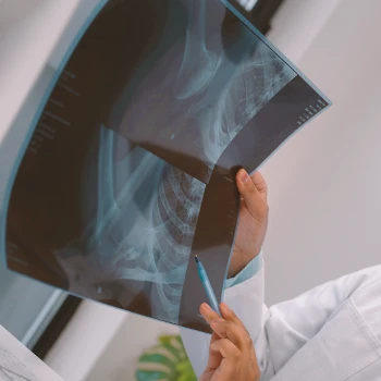 A doctor looking at bone density